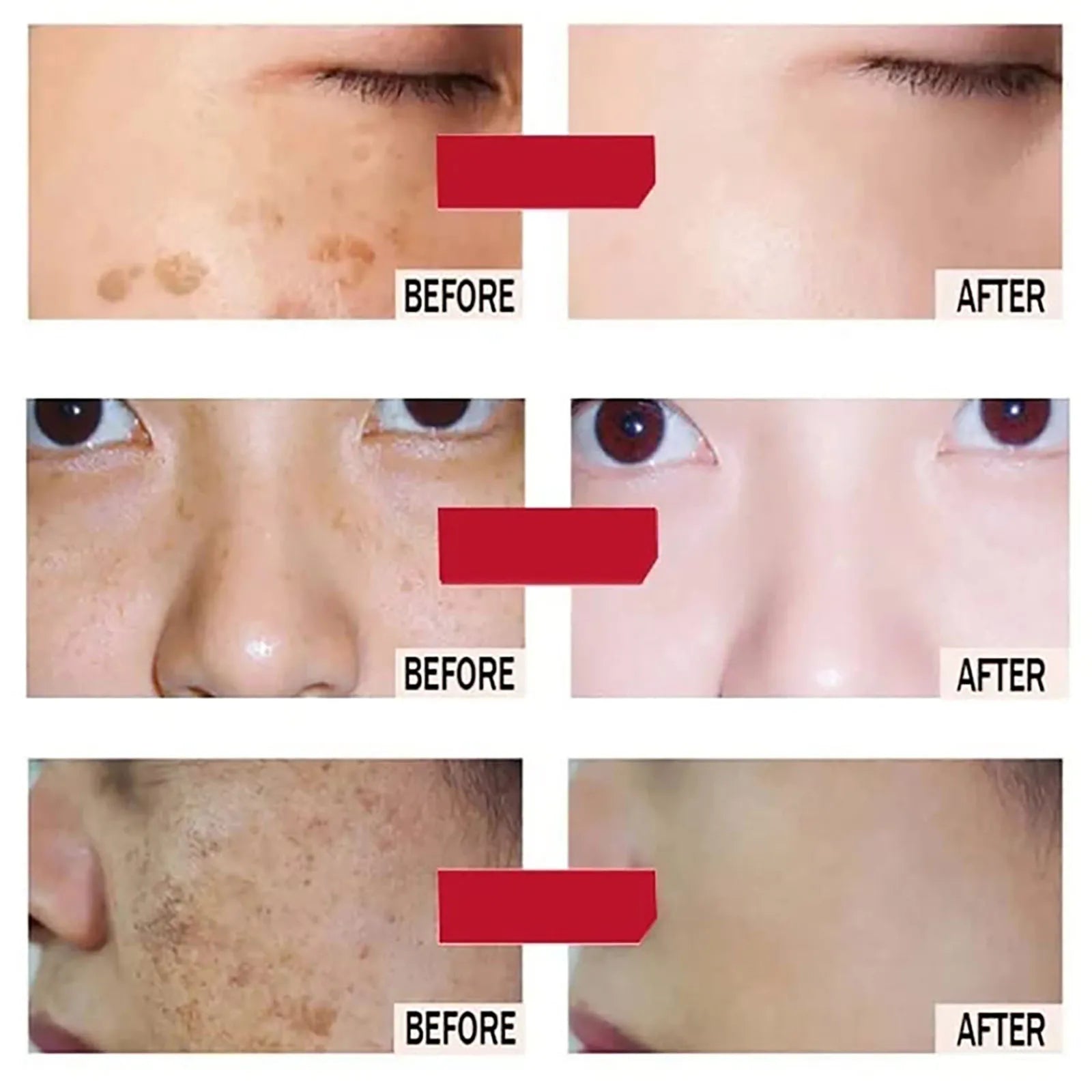 AILKE 24k Gold Perfect Flawlessly Face Cream, Whitening, Reduce Dark Spots, Melanin, Improve Dull Skin, With Glutathione Vitamin